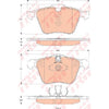 TRW Disc Brake Pad Set GDB1835